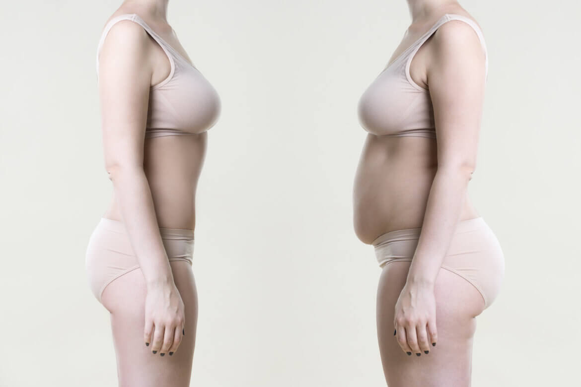 Laser Liposuction Results: Are They Immediate